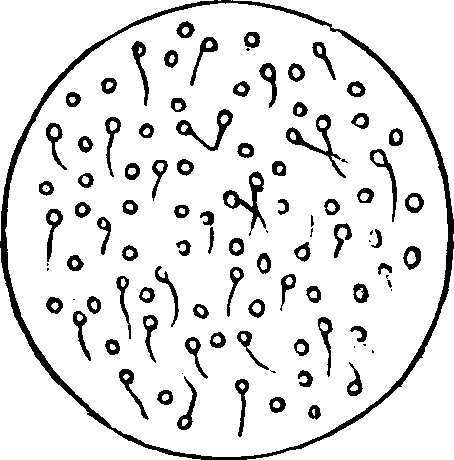 Illustration:
Fig. 4. Microscopic appearance of semen which will not fecundate.