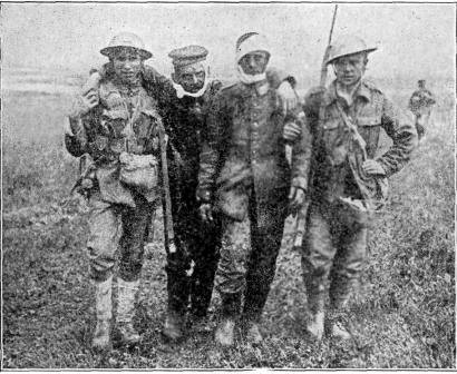 COMRADES AFTER
THE BATTLE

Soldiers bringing in two wounded captives.

PHOTO BY CENTRAL PHOTO SERVICE. N.Y.