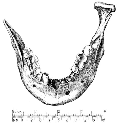 Drawing of a bone