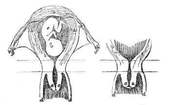 The neck of the Womb